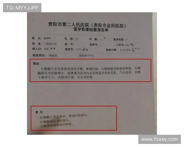 大邱主力中卫洪正云重伤被送医赛后确诊右颧骨塌陷骨折